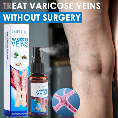 30ml Varicose Vein Spray Multi-Purpose Knee And Leg Care Spray Promote Blood Circulation BrandMe